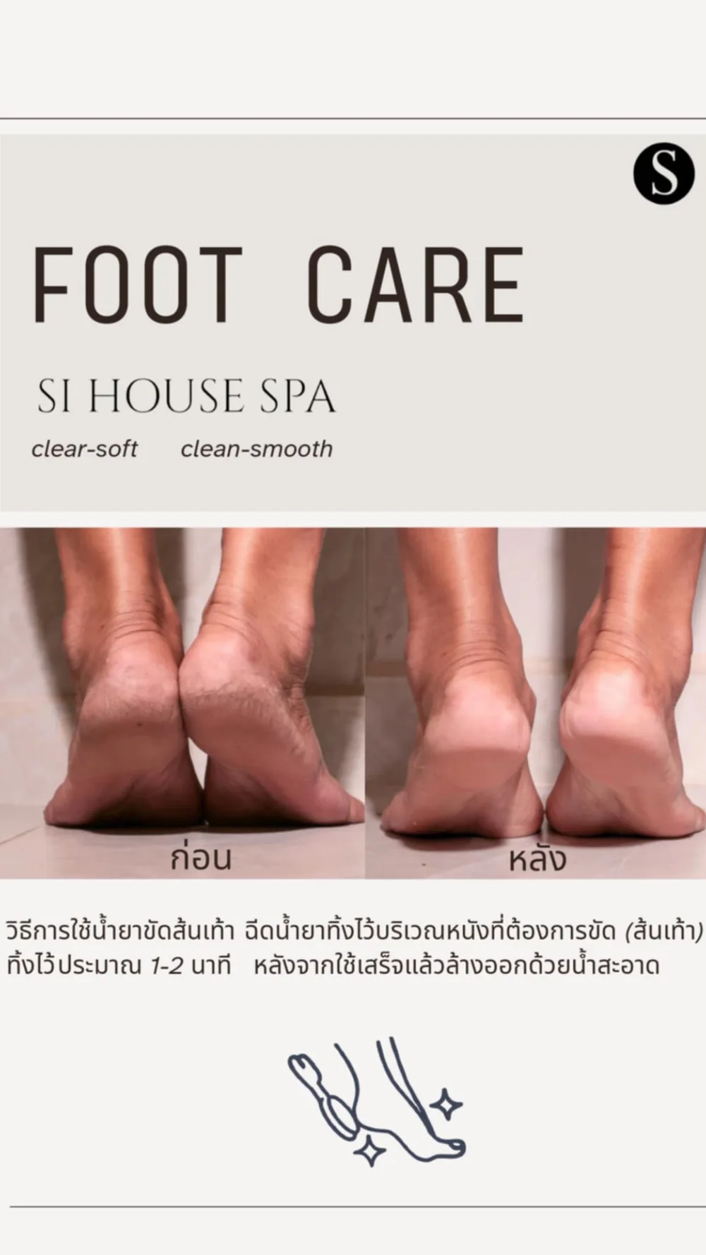 แผ่นข้อมูล Foot Care แสดงขั้นตอนการใช้และผลก่อน–หลัง